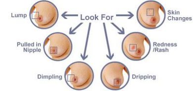 Let’s be smart and learn how to self-examine breasts