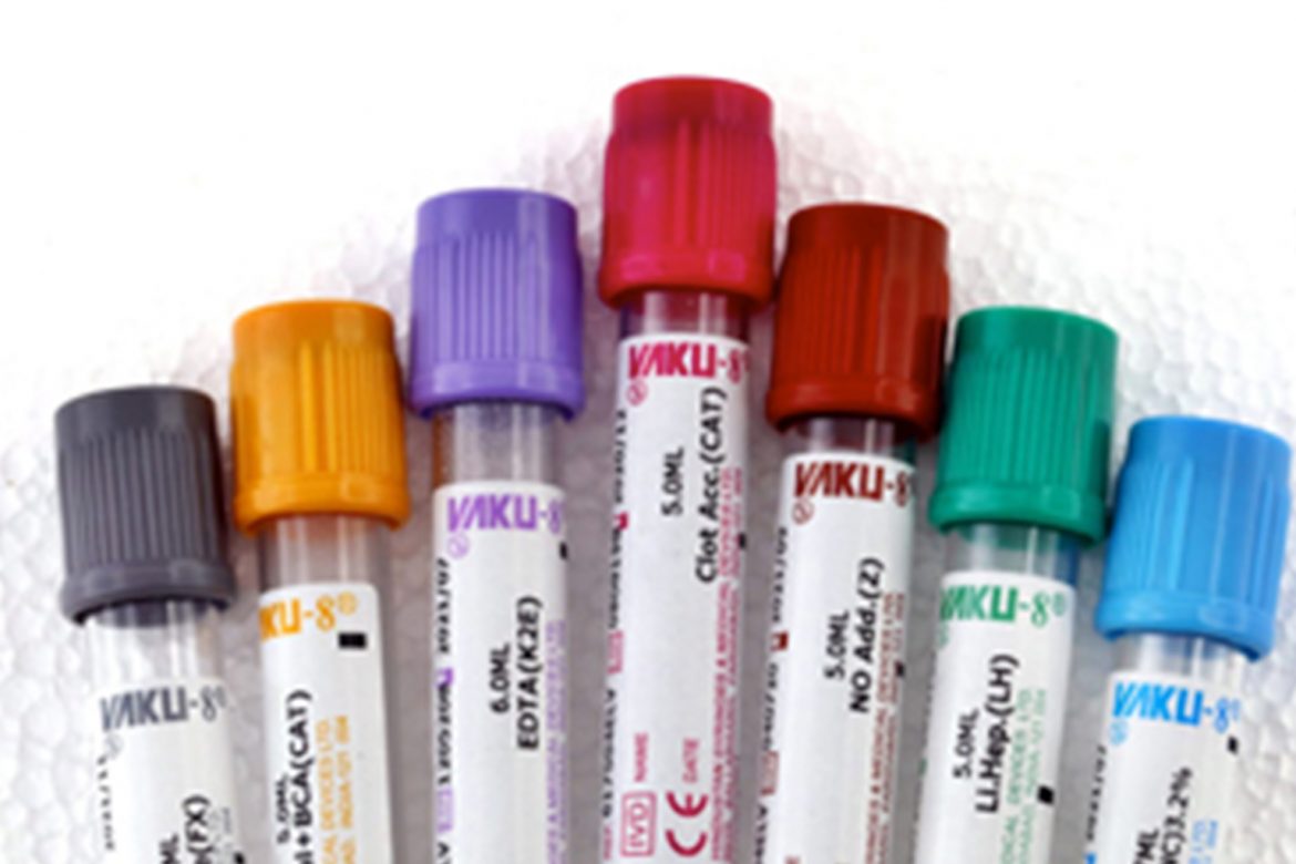 Decoding-the-Colour-Codes-of-Evacuated-Blood-Collection-Tubes-1.jpg