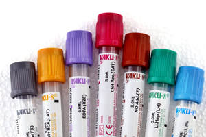Decoding-the-Colour-Codes-of-Evacuated-Blood-Collection-Tubes.jpg