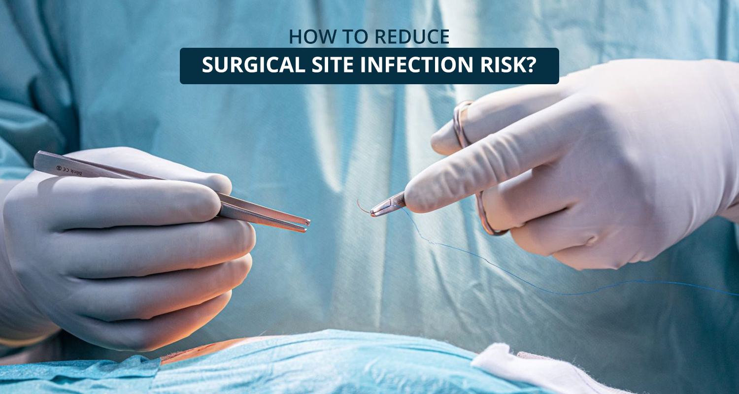 How-to-reduce-surgical-site-infection-risk-1500x800