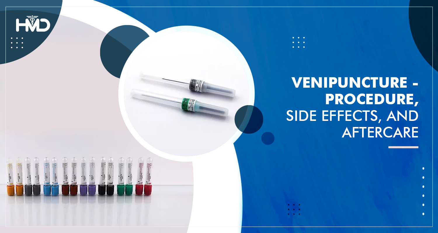 Venipuncture – Procedure, Side Effects, and Aftercare